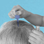 Finally, a Non-Invasive Hair Loss Treatment that Works