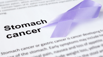 stomach cancer - fitnessnews24