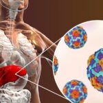 Hepatitis - fitnessnews24